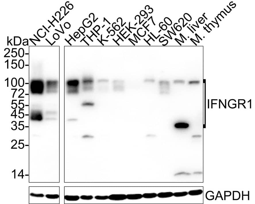 Western Blot: IFN-gamma R1/CD119 Antibody (JE40-50) [NBP3-32458] - Western blot analysis of IFN-gamma R1/CD119 on different lysates with Rabbit anti-IFN-gamma R1/CD119 antibody (NBP3-32458) at 1/1,000 dilution. Lane 1: NCI-H226 cell lysate (20 ug/Lane) Lane 2: LoVo cell lysate (20 ug/Lane) Lane 3: HepG2 cell lysate (20 ug/Lane) Lane 4: THP-1 cell lysate (20 ug/Lane) Lane 5: K-562 cell lysate (20 ug/Lane) Lane 6: HEK-293 cell lysate (20 ug/Lane) Lane 7: MCF7 cell lysate (negative) (20 ug/Lane) Lane 8: HL-60 cell lysate (20 ug/Lane) Lane 9: SW620 cell lysate (20 ug/Lane) Lane 10: Mouse liver tissue lysate (40 ug/Lane) Lane 11: Mouse thymus tissue lysate (40 ug/Lane) Predicted band size: 54 kDa Observed band size: 40-100 kDa Exposure time: 1 minute 2 seconds; ECL; 4-20% SDS-PAGE gel. Proteins were transferred to a PVDF membrane and blocked with 5% NFDM/TBST for 1 hour at room temperature. The primary antibody (NBP3-32458) at 1/1,000 dilution was used in 5% NFDM/TBST at 4  overnight. Goat Anti-Rabbit IgG - HRP Secondary Antibody at 1/50,000 dilution was used for 1 hour at room temperature.