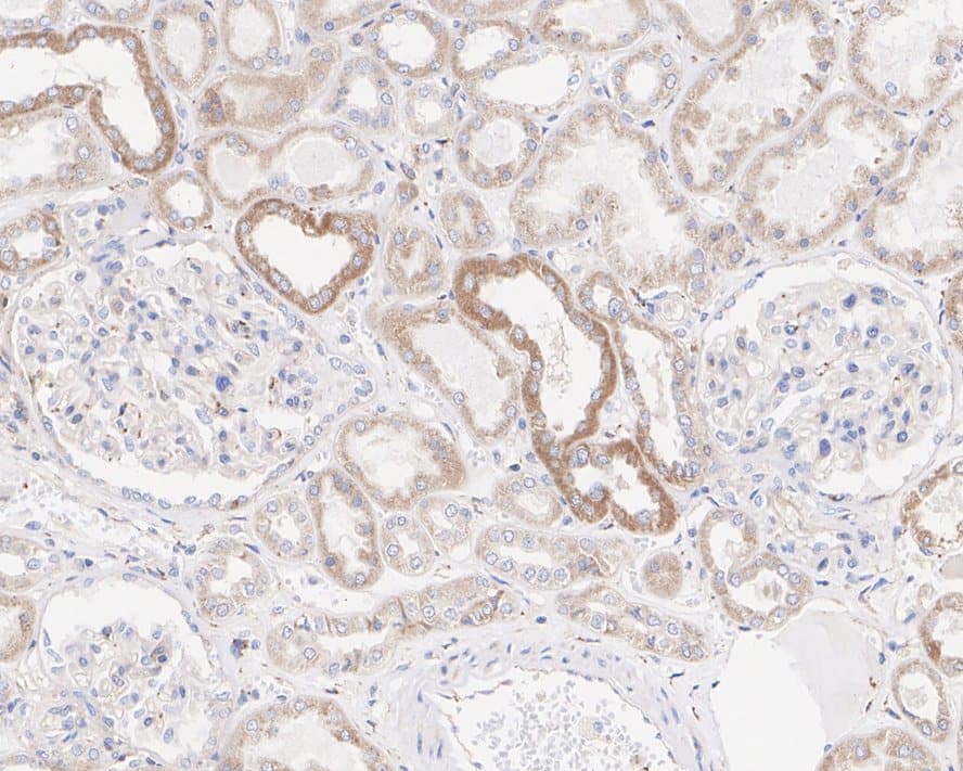 Immunohistochemistry: IFN-gamma R1/CD119 Antibody (JE40-50) [NBP3-32458] - Immunohistochemical analysis of paraffin-embedded human kidney tissue with Rabbit anti-IFN-gamma R1/CD119 antibody (NBP3-32458) at 1/2,000 dilution. The section was pre-treated using heat mediated antigen retrieval with Tris-EDTA buffer (pH 9.0) for 20 minutes. The tissues were blocked in 1% BSA for 20 minutes at room temperature, washed with ddH2O and PBS, and then probed with the primary antibody (NBP3-32458) at 1/2,000 dilution for 1 hour at room temperature. The detection was performed using an HRP conjugated compact polymer system. DAB was used as the chromogen. Tissues were counterstained with hematoxylin and mounted with DPX.