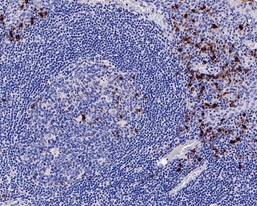 Immunohistochemistry: IgJ Antibody (PD00-89) [NBP3-32462] - Immunohistochemical analysis of paraffin-embedded human tonsil tissue with Rabbit anti-IgJ antibody (NBP3-32462) at 1/2,000 dilution. The section was pre-treated using heat mediated antigen retrieval with Tris-EDTA buffer (pH 9.0) for 20 minutes. The tissues were blocked in 1% BSA for 20 minutes at room temperature, washed with ddH2O and PBS, and then probed with the primary antibody (NBP3-32462) at 1/2,000 dilution for 1 hour at room temperature. The detection was performed using an HRP conjugated compact polymer system. DAB was used as the chromogen. Tissues were counterstained with hematoxylin and mounted with DPX.
