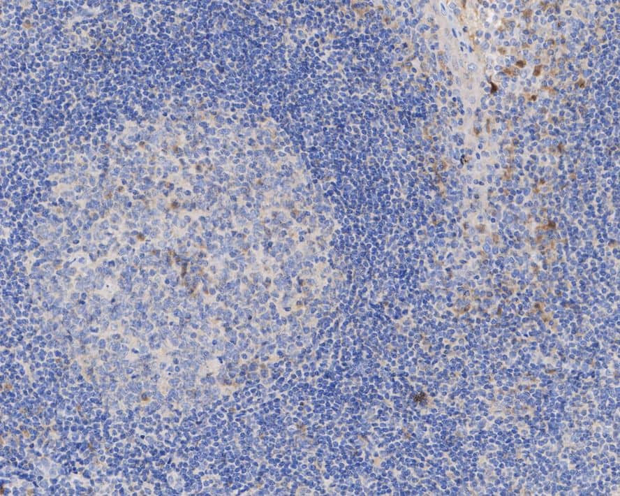 Immunohistochemistry: IL-1 beta/IL-1F2 Antibody (A7F7-R) [NBP3-32464] - Immunohistochemical analysis of paraffin-embedded human tonsil tissue with Mouse anti-IL-1 beta/IL-1F2 antibody (NBP3-32464) at 1/100 dilution. The section was pre-treated using heat mediated antigen retrieval with Tris-EDTA buffer (pH 9.0) for 20 minutes. The tissues were blocked in 1% BSA for 20 minutes at room temperature, washed with ddH2O and PBS, and then probed with the primary antibody (NBP3-32464) at 1/100 dilution for 1 hour at room temperature. The detection was performed using an HRP conjugated compact polymer system. DAB was used as the chromogen. Tissues were counterstained with hematoxylin and mounted with DPX.