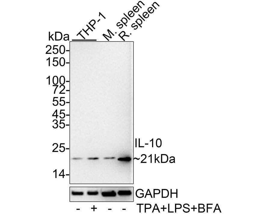 Western blot analysis on different lysates with NBP3-32465 at 1/1,000 dilution. Lane 1: THP-1 cell lysate (30 µg/Lane) Lane 2: THP-1 treated with 80nM TPA overnight then treated with 100ng/mL LPS for 6 hours add 300ng/mL BFA for 3 hours cell lysate (30 µg/Lane) Lane 3: Mouse spleen tissue lysate (40 µg/Lane) Lane 4: Rat spleen tissue lysate (40 µg/Lane) Predicted band size: 21 kDa Observed band size: 21 kDa Exposure time: 1 minutes 59 seconds; 4-20% SDS-PAGE gel. Proteins were transferred to a PVDF membrane and blocked with 5% NFDM/TBST for 1 hour at room temperature. NBP3-32465 at 1/1,000 dilution was used in 5% NFDM/TBST at 4℃ overnight. Goat Anti-Rabbit IgG [HRP] Secondary Antibody at 1/50,000 dilution was used for 1 hour at room temperature.