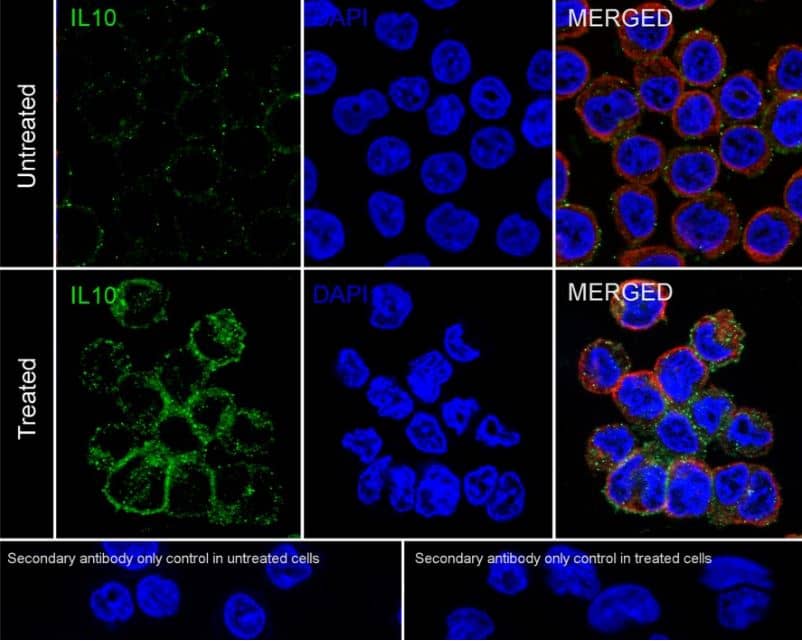 ICC/IF:IL-10 Antibody (JE59-71)-NBP3-32465-Analysis of THP-1 cells treated with 80nM TPA overnight then treated with 100ng/mL LPS for 6 hours add 300ng/mL BFA for 3 hours labeling IL-10 with Rabbit anti-IL-10 antibody at 1/500 dilution.Cells were fixed in 4% paraformaldehyde for 20 minutes at room temperature, permeabilized with 0.1% Triton X-100 in PBS for 5 minutes at room temperature, then blocked with 1% BSA in 10% negative goat serum for 1 hour at room temperature. Cells were then incubated with Rabbit anti-IL-10 antibody at 1/500 dilution in 1% BSA in PBST overnight at 4 ℃. Goat Anti-Rabbit IgG H&L (iFluor™ 488) was used as the secondary antibody at 1/1,000 dilution. PBS instead of the primary antibody was used as the secondary antibody only control. Nuclear DNA was labelled in blue with DAPI.Beta tubulin (red) was stained at 1/100 dilution overnight at +4℃. Goat Anti-Mouse IgG H&L (iFluor™ 594,) was used as the secondary antibody at 1/1,000 dilution.