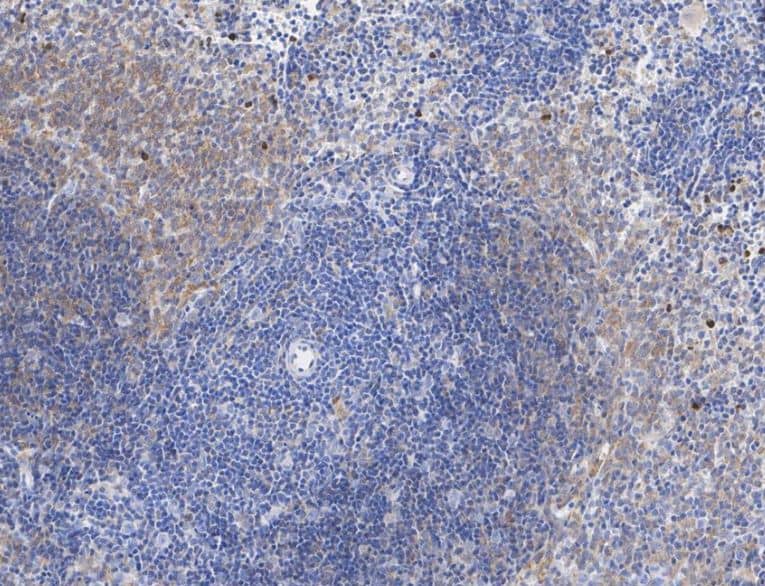 Immunohistochemistry-Paraffin:IL-10 Antibody (JE59-71)-NBP3-32465-Rat spleen tissue with Rabbit anti-IL-10 antibody at 1/1,000 dilution.The section was pre-treated using heat mediated antigen retrieval with Tris-EDTA buffer (pH 9.0) for 20 minutes. The tissues were blocked in 1% BSA for 20 minutes at room temperature, washed with ddH2O and PBS, and then probed with the primary antibody at 1/1,000 dilution for 1 hour at room temperature. The detection was performed using an HRP conjugated compact polymer system. DAB was used as the chromogen. Tissues were counterstained with hematoxylin and mounted with DPX.