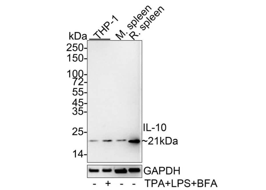 Western Blot:IL-10 Antibody (JE59-71)-NBP3-32465-Analysis of IL-10 on different lysates with Rabbit anti-IL-10 antibody at 1/1,000 dilution.Lane 1: THP-1 cell lysate (30 ug/Lane)Lane 2: THP-1 treated with 80nM TPA overnight then treated with 100ng/mL LPS for 6 hours add 300ng/mL BFA for 3 hours cell lysate (30 µg/Lane)Lane 3: Mouse spleen tissue lysate (40 ug/Lane)Lane 4: Rat spleen tissue lysate (40 ug/Lane)Predicted band size: 21 kDaObserved band size: 21 kDaExposure time: 1 minutes 59 seconds;4-20% SDS-PAGE gel.Proteins were transferred to a PVDF membrane and blocked with 5% NFDM/TBST for 1 hour at room temperature. The primary antibody at 1/1,000 dilution was used in 5% NFDM/TBST at 4℃ overnight. Goat Anti-Rabbit IgG - HRP Secondary Antibody at 1/50,000 dilution was used for 1 hour at room temperature.