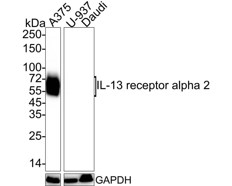 Western Blot: IL-13R alpha 2 Antibody (PSH03-85) [NBP3-32466] - Western blot analysis of IL-13R alpha 2 on different lysates with Rabbit anti-IL-13R alpha 2 antibody (NBP3-32466) at 1/2,000 dilution. Lane 1: A375 cell lysate (no heat) Lane 2: U-937 cell lysate (no heat) (negative) Lane 3: Daudi cell lysate (negative) Lysates/proteins at 20 ug/Lane. Predicted band size: 44 kDa Observed band size: 50-80 kDa Exposure time: 25 seconds; 4-20% SDS-PAGE gel. Proteins were transferred to a PVDF membrane and blocked with 5% NFDM/TBST for 1 hour at room temperature. The primary antibody (NBP3-32466) at 1/2,000 dilution was used in 5% NFDM/TBST at 4  overnight. Goat Anti-Rabbit IgG - HRP Secondary Antibody at 1/50,000 dilution was used for 1 hour at room temperature.
