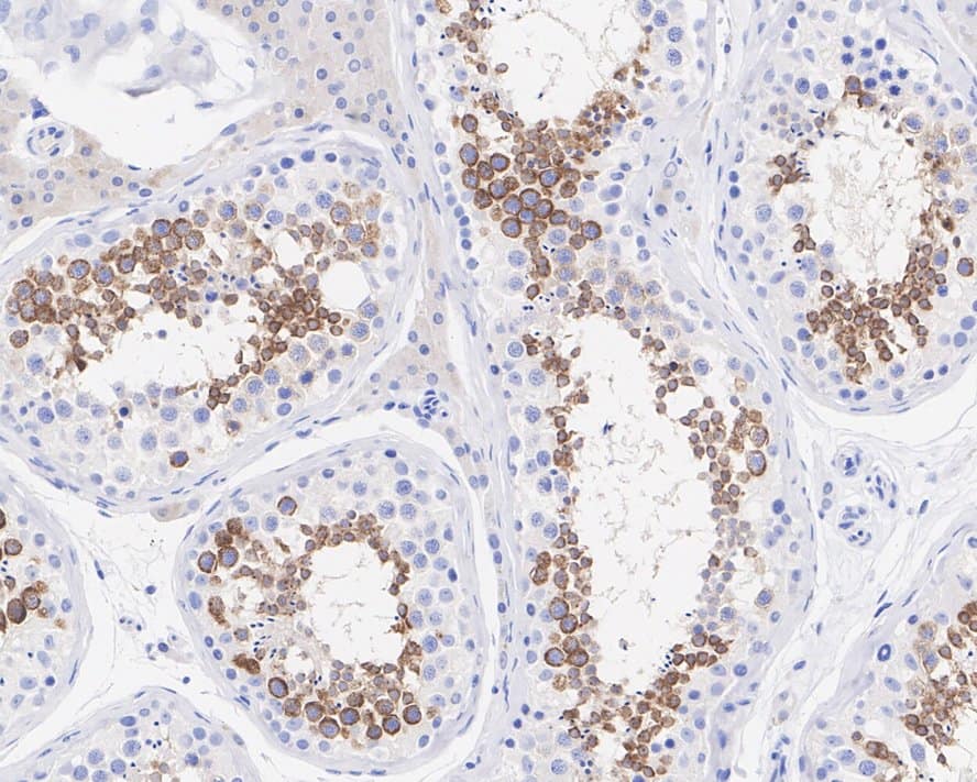 Immunohistochemistry: IL-13R alpha 2 Antibody (PSH03-85) [NBP3-32466] - Immunohistochemical analysis of paraffin-embedded human testis tissue with Rabbit anti-IL-13R alpha 2 antibody (NBP3-32466) at 1/1,000 dilution. The section was pre-treated using heat mediated antigen retrieval with Tris-EDTA buffer (pH 9.0) for 20 minutes. The tissues were blocked in 1% BSA for 20 minutes at room temperature, washed with ddH2O and PBS, and then probed with the primary antibody (NBP3-32466) at 1/1,000 dilution for 1 hour at room temperature. The detection was performed using an HRP conjugated compact polymer system. DAB was used as the chromogen. Tissues were counterstained with hematoxylin and mounted with DPX.