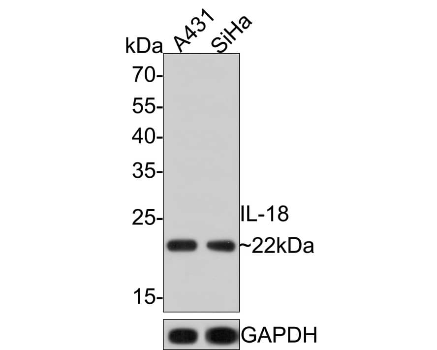 Western Blot: IL-18/IL-1F4 Antibody (PS00-41) [NBP3-32468] - Western blot analysis of IL-18/IL-1F4 on different lysates with Rabbit anti-IL-18/IL-1F4 antibody (NBP3-32468) at 1/1,000 dilution. Lane 1: A431 cell lysate Lane 2: SiHa cell lysate Lysates/proteins at 10 ug/Lane. Predicted band size: 22 kDa Observed band size: 22 kDa Exposure time: 2 minutes; 12% SDS-PAGE gel. Proteins were transferred to a PVDF membrane and blocked with 5% NFDM/TBST for 1 hour at room temperature. The primary antibody (NBP3-32468) at 1/1,000 dilution was used in 5% NFDM/TBST at room temperature for 2 hours. Goat Anti-Rabbit IgG - HRP Secondary Antibody at 1:100,000 dilution was used for 1 hour at room temperature.