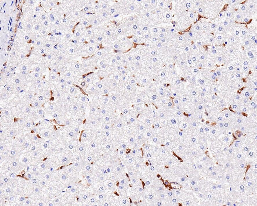 Immunohistochemistry: IL-18/IL-1F4 Antibody (PS00-41) [NBP3-32468] - Immunohistochemical analysis of paraffin-embedded human liver tissue with Rabbit anti-IL-18/IL-1F4 antibody (NBP3-32468) at 1/1,000 dilution. The section was pre-treated using heat mediated antigen retrieval with Tris-EDTA buffer (pH 9.0) for 20 minutes. The tissues were blocked in 1% BSA for 20 minutes at room temperature, washed with ddH2O and PBS, and then probed with the primary antibody (NBP3-32468) at 1/1,000 dilution for 1 hour at room temperature. The detection was performed using an HRP conjugated compact polymer system. DAB was used as the chromogen. Tissues were counterstained with hematoxylin and mounted with DPX.