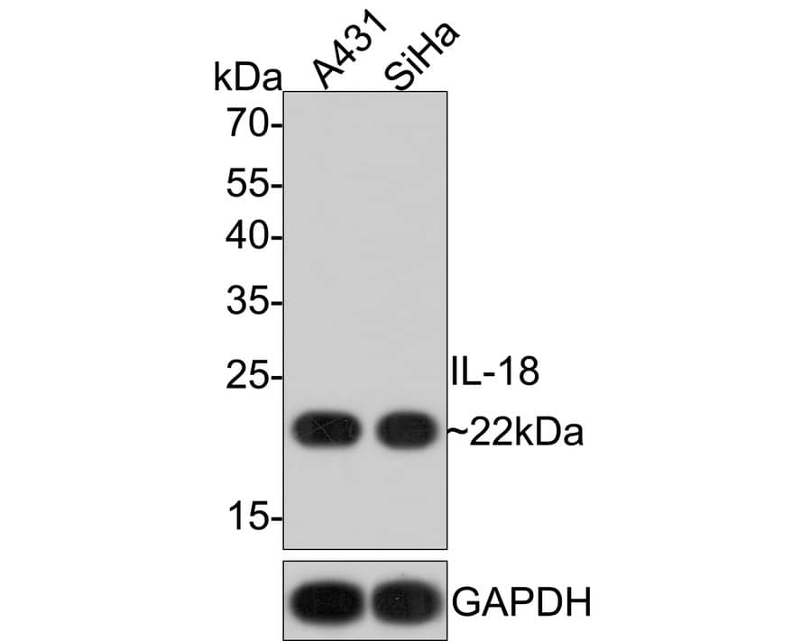 Western Blot: IL-18/IL-1F4 Antibody (PS01-06) [NBP3-32469] - Western blot analysis of IL-18/IL-1F4 on different lysates with Rabbit anti-IL-18/IL-1F4 antibody (NBP3-32469) at 1/1,000 dilution. Lane 1: A431 cell lysate Lane 2: SiHa cell lysate Lysates/proteins at 10 ug/Lane. Predicted band size: 22 kDa Observed band size: 22 kDa Exposure time: 2 minutes; 12% SDS-PAGE gel. Proteins were transferred to a PVDF membrane and blocked with 5% NFDM/TBST for 1 hour at room temperature. The primary antibody (NBP3-32469) at 1/1,000 dilution was used in 5% NFDM/TBST at room temperature for 2 hours. Goat Anti-Rabbit IgG - HRP Secondary Antibody at 1:100,000 dilution was used for 1 hour at room temperature.