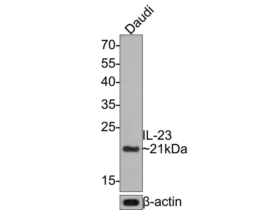 Western Blot: IL-23 Antibody (JE38-99) [NBP3-32470] - Western blot analysis of IL-23 on Daudi cell lysates with Rabbit anti-IL-23 antibody (NBP3-32470) at 1/500 dilution. Lysates/proteins at 10 ug/Lane. Predicted band size: 21 kDa Observed band size: 21 kDa Exposure time: 2 minutes; 12% SDS-PAGE gel. Proteins were transferred to a PVDF membrane and blocked with 5% NFDM/TBST for 1 hour at room temperature. The primary antibody (NBP3-32470) at 1/500 dilution was used in 5% NFDM/TBST at room temperature for 2 hours. Goat Anti-Rabbit IgG - HRP Secondary Antibody at 1:300,000 dilution was used for 1 hour at room temperature.