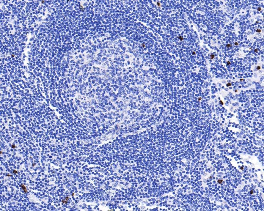 Immunohistochemistry: IL-23 Antibody (JE38-99) [NBP3-32470] - Immunohistochemical analysis of paraffin-embedded human lymph nodes tissue with Rabbit anti-IL-23 antibody (NBP3-32470) at 1/400 dilution. The section was pre-treated using heat mediated antigen retrieval with Tris-EDTA buffer (pH 9.0) for 20 minutes. The tissues were blocked in 1% BSA for 20 minutes at room temperature, washed with ddH2O and PBS, and then probed with the primary antibody (NBP3-32470) at 1/400 dilution for 1 hour at room temperature. The detection was performed using an HRP conjugated compact polymer system. DAB was used as the chromogen. Tissues were counterstained with hematoxylin and mounted with DPX.