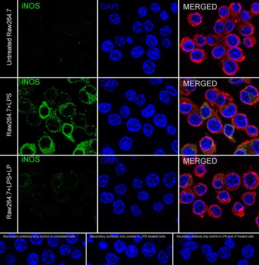 Immunocytochemistry/ Immunofluorescence: iNOS Antibody (PSH03-69) [NBP3-32473] - Immunocytochemistry analysis of RAW264.7 cells treated with or without 1μg/mL LPS for 6 hours labeling iNOS with Rabbit anti-iNOS antibody (NBP3-32473) at 1/100 dilution. Cells were fixed in 100% precooled methanol for 5 minutes at room temperature, then blocked with 1% BSA in 10% negative goat serum for 1 hour at room temperature. Cells were then incubated with Rabbit anti-iNOS antibody (NBP3-32473) at 1/100 dilution in 1% BSA in PBST overnight at 4 ℃. Goat Anti-Rabbit IgG H&L (iFluor™ 488) was used as the secondary antibody at 1/1,000 dilution. PBS instead of the primary antibody was used as the secondary antibody only control. Nuclear DNA was labelled in blue with DAPI. Beta tubulin (red) was stained at 1/100 dilution overnight at +4℃. Goat Anti-Mouse IgG H&L (iFluor™ 594) was used as the secondary antibody at 1/1,000 dilution.