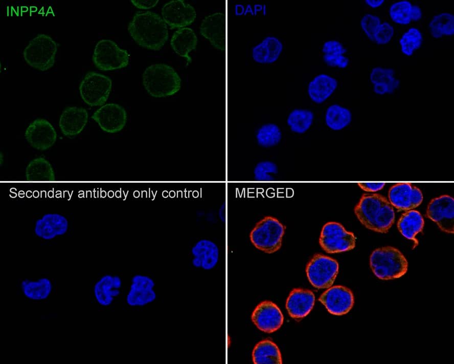Immunocytochemistry/ Immunofluorescence INPP4A Antibody (PSH01-27)