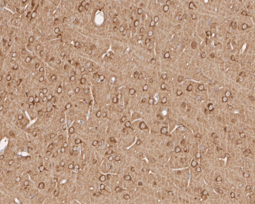 Immunohistochemistry INPP4A Antibody (PSH01-27)