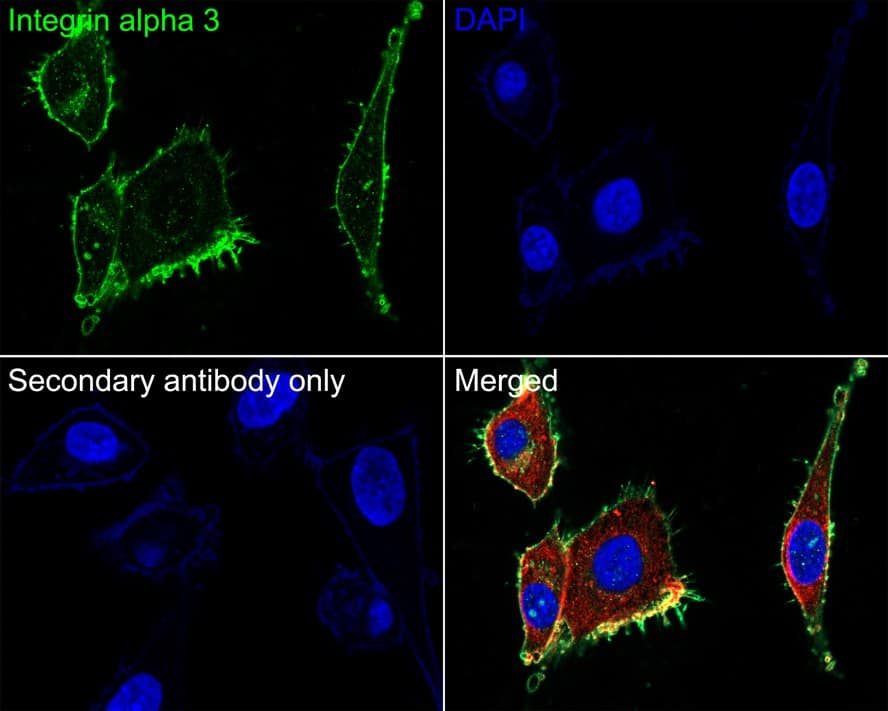 Immunocytochemistry/ Immunofluorescence: Integrin alpha 3/CD49c Antibody (A7H2) [NBP3-32475] - Immunocytochemistry analysis of U-87 MG cells labeling Integrin alpha 3/CD49c with Mouse anti-Integrin alpha 3/CD49c/CD49c antibody (NBP3-32475) at 1/100 dilution. Cells were fixed in 100% precooled methanol for 5 minutes at room temperature, then blocked with 1% BSA in 10% negative goat serum for 1 hour at room temperature. Cells were then incubated with Mouse anti-Integrin alpha 3/CD49c antibody (NBP3-32475) at 1/100 dilution in 1% BSA in PBST overnight at 4 ℃. Goat Anti-Mouse IgG H&L (iFluor™ 488) was used as the secondary antibody at 1/1,000 dilution. PBS instead of the primary antibody was used as the secondary antibody only control. Nuclear DNA was labelled in blue with DAPI. beta Tubulin (red) was stained at 1/100 dilution overnight at +4℃. Goat Anti-Rabbit IgG H&L (iFluor™ 594) were used as the secondary antibody at 1/1,000 dilution.