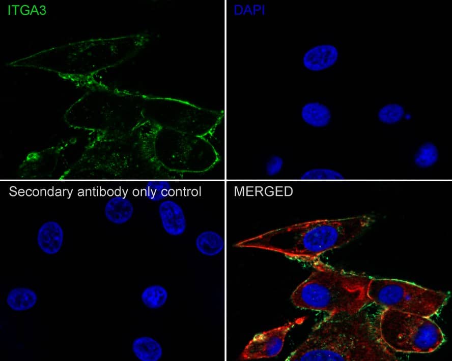 Immunocytochemistry/ Immunofluorescence: Integrin alpha 3/CD49c Antibody (A7H2-R) [NBP3-32476] - Immunocytochemistry analysis of U-87 MG cells labeling Integrin alpha 3/CD49c with Mouse anti-Integrin alpha 3/CD49c antibody (NBP3-32476) at 1/100 dilution. Cells were fixed in 100% precooled methanol for 5 minutes at room temperature, then blocked with 1% BSA in 10% negative goat serum for 1 hour at room temperature. Cells were then incubated with Mouse anti-Integrin alpha 3/CD49c antibody (NBP3-32476) at 1/100 dilution in 1% BSA in PBST overnight at 4 ℃. Goat Anti-Mouse IgG H&L (iFluor™ 488) was used as the secondary antibody at 1/1,000 dilution. PBS instead of the primary antibody was used as the secondary antibody only control. Nuclear DNA was labelled in blue with DAPI. beta Tubulin (red) was stained at 1/100 dilution overnight at +4℃. Goat Anti-Rabbit IgG H&L (iFluor™ 594) were used as the secondary antibody at 1/1,000 dilution.