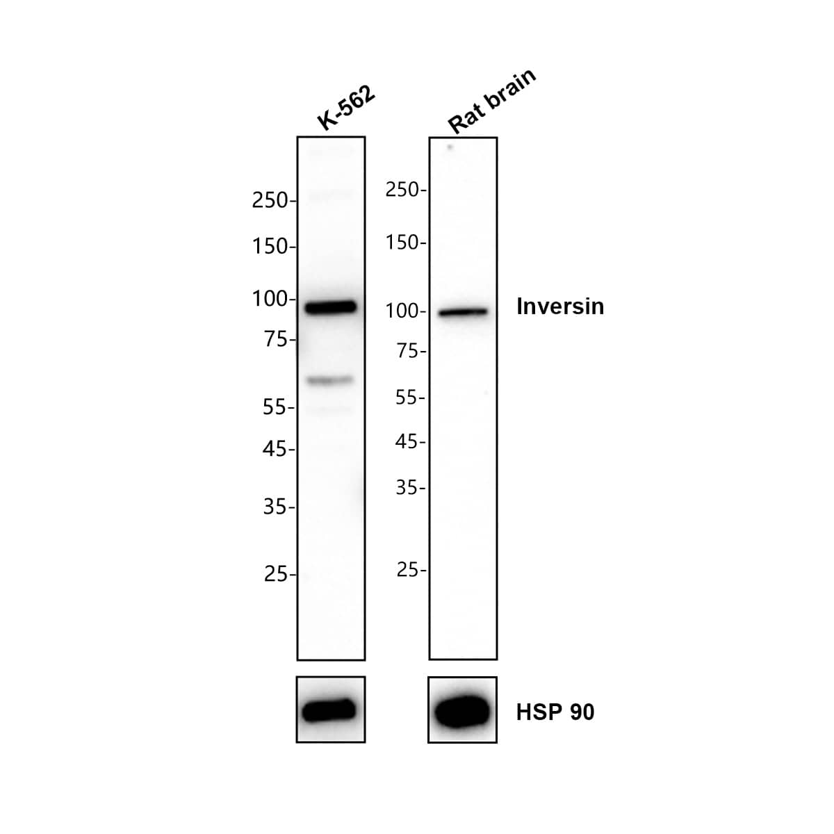 Western blot analysis on different lysates with NBP3-32477 at 1/1,000 dilution. Lane 1: 293T (Human embryonic kidney cell) cell lysate Lane 2: Rat brain tissue lysate Lysates/proteins at 10 µg/Lane. Exposure time: 59 seconds Blocking: 5% NFDM/TBST, 1 hour at room temperature Primary antibody: NBP3-32477, 1/1,000 in 5% NFDM/TBST, overnight at 4 ℃ Secondary antibody: Goat Anti-Rabbit IgG [HRP] Secondary Antibody, 1/50,000 in 5% NFDM/TBST, 1 hour at room temperature Predicted band size: 117.8 kDa Observed band size: 95 kDa