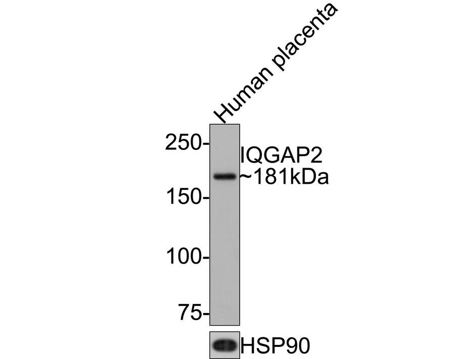 Western blot analysis of  human placenta tissue lysates with NBP3-32481 at 1/5,000 dilution. Lysates/proteins at 10 µg/Lane. Predicted band size: 181 kDa Observed band size: 181 kDa Exposure time: 1 minute; 6% SDS-PAGE gel. Proteins were transferred to a PVDF membrane and blocked with 5% NFDM/TBST for 1 hour at room temperature. NBP3-32481 at 1/5,000 dilution was used in 5% NFDM/TBST at room temperature for 2 hours. Goat Anti-Rabbit IgG [HRP] Secondary Antibody at 1:300,000 dilution was used for 1 hour at room temperature.