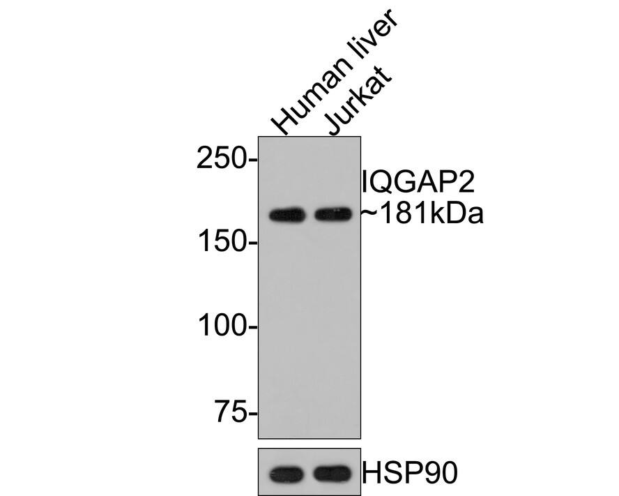 Western blot analysis on different lysates with NBP3-32481 at 1/1,000 dilution. Lane 1: Human liver tissue lysate (20 µg/Lane) Lane 2: Jurkat cell lysate (10 µg/Lane) Predicted band size: 181 kDa Observed band size: 181 kDa Exposure time: 2 minutes; 6% SDS-PAGE gel. Proteins were transferred to a PVDF membrane and blocked with 5% NFDM/TBST for 1 hour at room temperature. NBP3-32481 at 1/1,000 dilution was used in 5% NFDM/TBST at room temperature for 2 hours. Goat Anti-Rabbit IgG [HRP] Secondary Antibody at 1:300,000 dilution was used for 1 hour at room temperature.