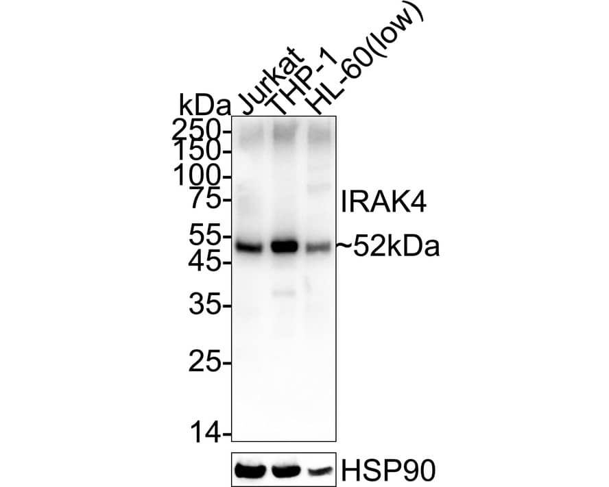 Western blot analysis on different lysates with NBP3-32482 at 1/2,000 dilution. Lane 1: Jurkat cell lysate Lane 2: THP-1 cell lysate Lane 3: HL-60 cell lysate (low expression) Lysates/proteins at 20 µg/Lane. Predicted band size: 52 kDa Observed band size: 52 kDa Exposure time: 25 seconds;  4-20% SDS-PAGE gel. Proteins were transferred to a PVDF membrane and blocked with 5% NFDM/TBST for 1 hour at room temperature. NBP3-32482 at 1/2,000 dilution was used in primary antibody dilution at 4℃ overnight. Goat Anti-Rabbit IgG [HRP] Secondary Antibody at 1/50,000 dilution was used for 1 hour at room temperature.