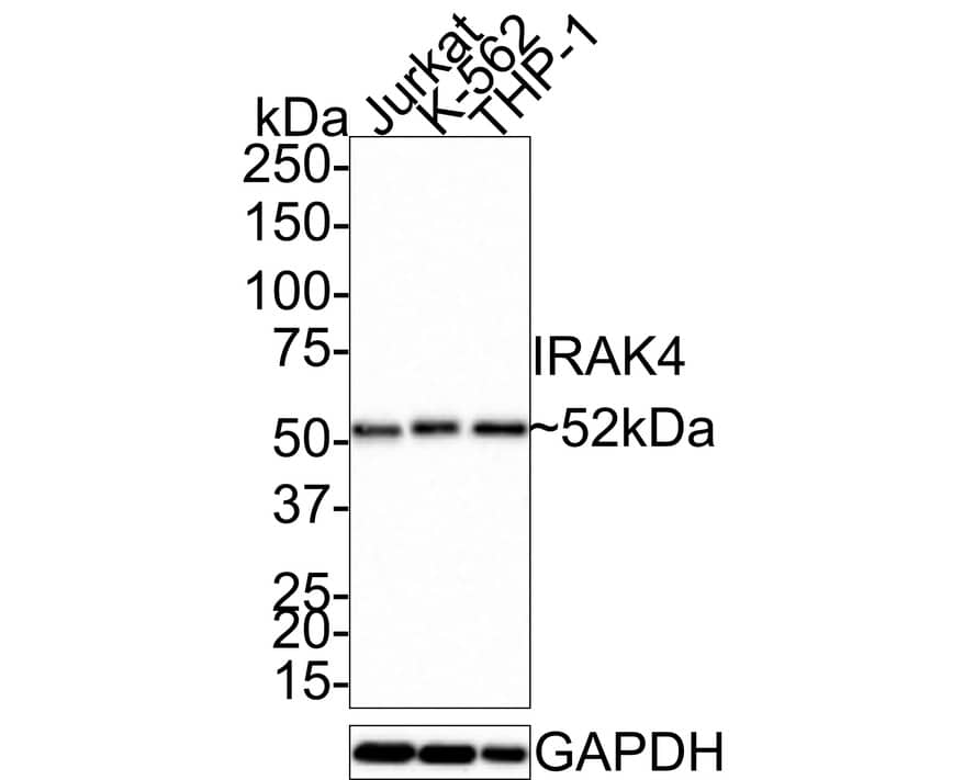 Western Blot: IRAK4 Antibody (JE41-77) [NBP3-32482] - Western blot analysis of IRAK4 on different lysates with Rabbit anti-IRAK4 antibody (NBP3-32482) at 1/1,000 dilution. Lane 1: Jurkat cell lysate Lane 2: K-562 cell lysate Lane 3: THP-1 cell lysate Lysates/proteins at 10 ug/Lane. Predicted band size: 52 kDa Observed band size: 52 kDa Exposure time: 22 seconds; 4-20% SDS-PAGE gel. Proteins were transferred to a PVDF membrane and blocked with 5% NFDM/TBST for 1 hour at room temperature. The primary antibody (NBP3-32482) at 1/1,000 dilution was used in 5% NFDM/TBST at room temperature for 2 hours. Goat Anti-Rabbit IgG - HRP Secondary Antibody at 1:200,000 dilution was used for 1 hour at room temperature.