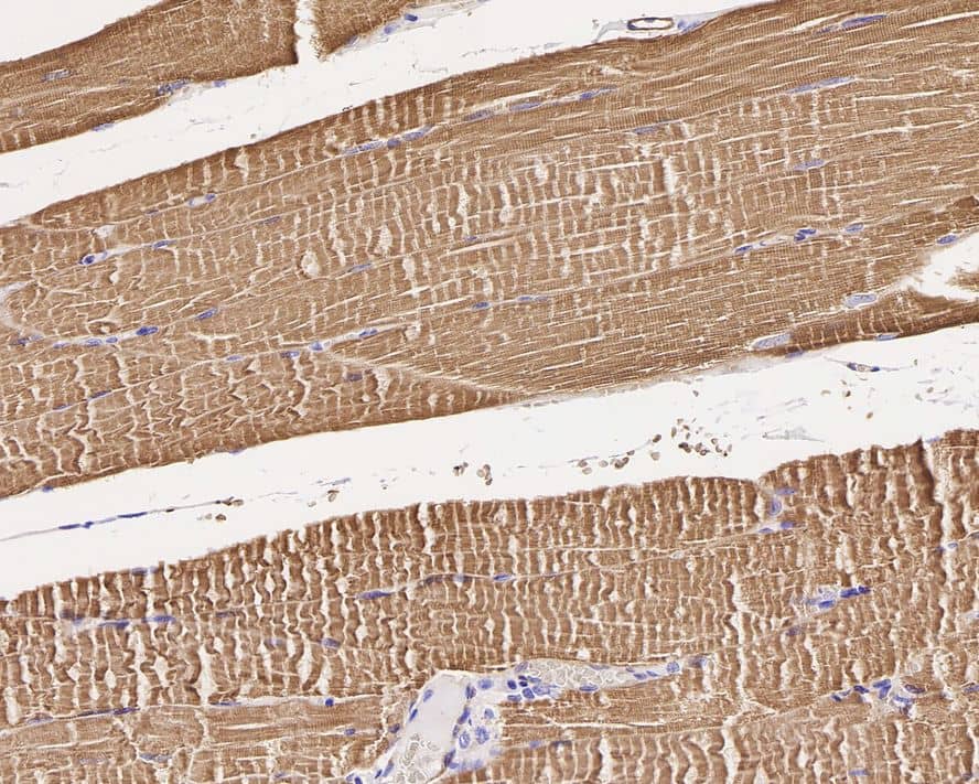 Immunohistochemistry: IRAK4 Antibody (JE41-77) [NBP3-32482] - Immunohistochemical analysis of paraffin-embedded human striated muscle tissue with Rabbit anti-IRAK4 antibody (NBP3-32482) at 1/1,000 dilution. The section was pre-treated using heat mediated antigen retrieval with Tris-EDTA buffer (pH 9.0) for 20 minutes. The tissues were blocked in 1% BSA for 20 minutes at room temperature, washed with ddH2O and PBS, and then probed with the primary antibody (NBP3-32482) at 1/1,000 dilution for 1 hour at room temperature. The detection was performed using an HRP conjugated compact polymer system. DAB was used as the chromogen. Tissues were counterstained with hematoxylin and mounted with DPX.