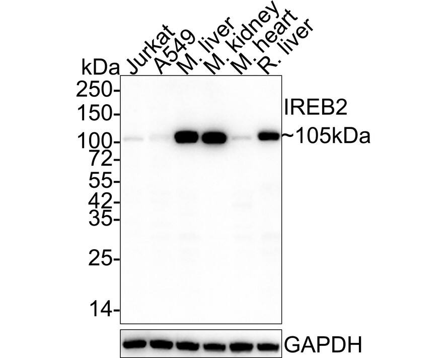 Western blot analysis on different lysates with NBP3-32483 at 1/2,000 dilution. Lane 1: Jurkat cell lysate (20 µg/Lane) Lane 2: A549 cell lysate (20 µg/Lane) Lane 3: Mouse liver tissue lysate (40 µg/Lane) Lane 4: Mouse kidney tissue lysate (40 µg/Lane) Lane 5: Mouse heart tissue lysate (40 µg/Lane) Lane 6: Rat liver tissue lysate (40 µg/Lane) Predicted band size: 105 kDa Observed band size: 105 kDa Exposure time: 25 seconds; 4-20% SDS-PAGE gel. Proteins were transferred to a PVDF membrane and blocked with 5% NFDM/TBST for 1 hour at room temperature. NBP3-32483 at 1/2,000 dilution was used in 5% NFDM/TBST at 4℃ overnight. Anti-Mouse IgG Secondary Antibody at 1/5,000 dilution was used for 1 hour at room temperature.