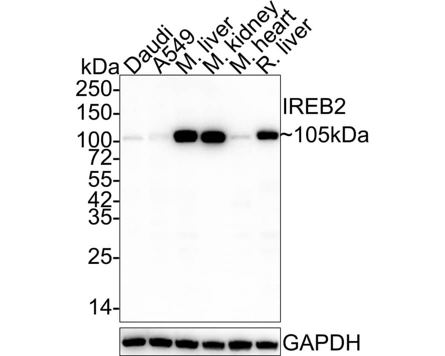 Western Blot IRP2 Antibody (9D1-R)