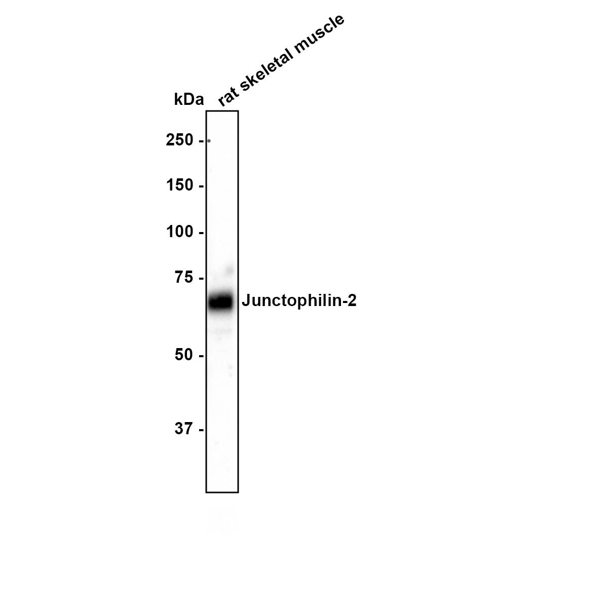 Western Blot JPH2 Antibody (3-2-R)