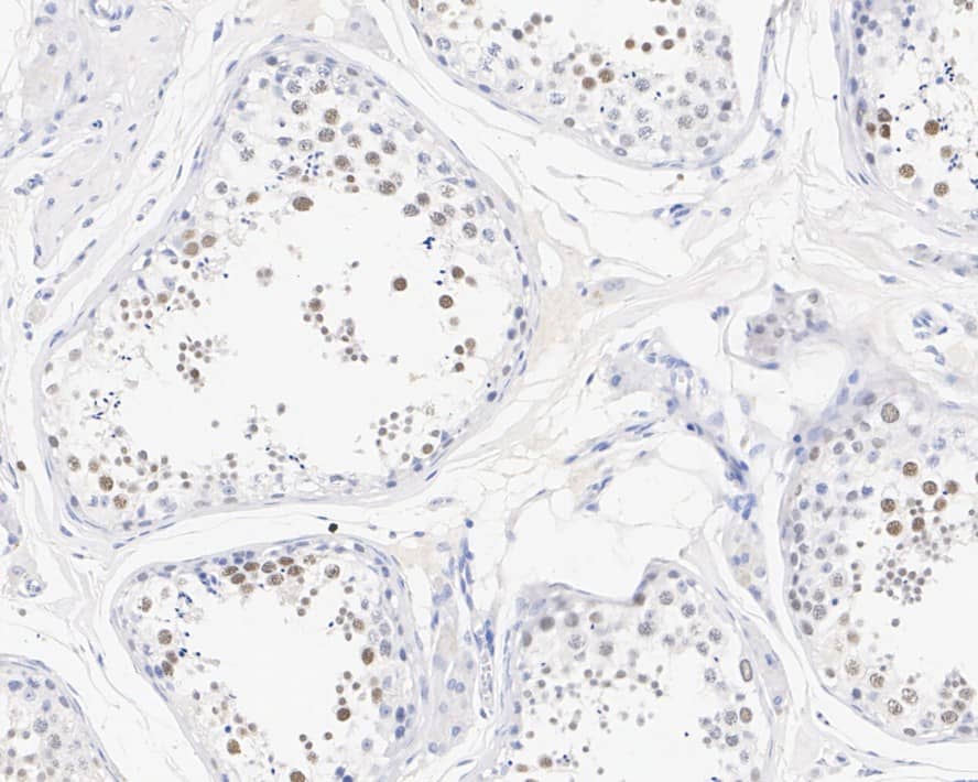 Immunohistochemistry: Lysine (K)-specific Demethylase 3A/KDM3A/JMJD1A Antibody (PSH01-77) [NBP3-32490] - Immunohistochemical analysis of paraffin-embedded human testis tissue with Rabbit anti-Lysine (K)-specific Demethylase 3A/KDM3A/JMJD1A antibody (NBP3-32490) at 1/200 dilution. The section was pre-treated using heat mediated antigen retrieval with sodium citrate buffer (pH 6.0) for 2 minutes. The tissues were blocked in 1% BSA for 20 minutes at room temperature, washed with ddH2O and PBS, and then probed with the primary antibody (NBP3-32490) at 1/200 dilution for 1 hour at room temperature. The detection was performed using an HRP conjugated compact polymer system. DAB was used as the chromogen. Tissues were counterstained with hematoxylin and mounted with DPX.