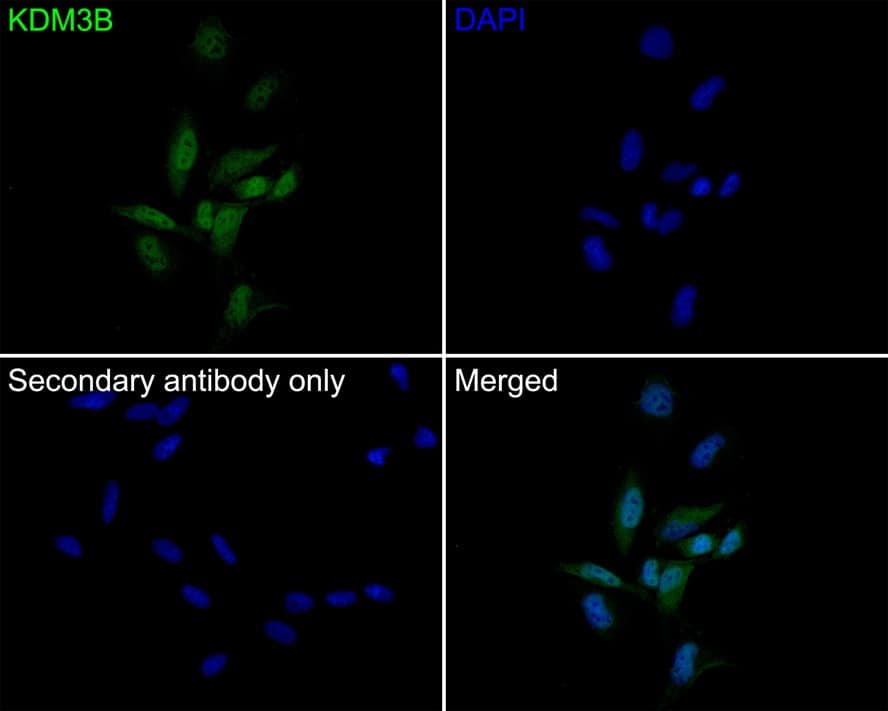 Immunocytochemistry/ Immunofluorescence: JMJD1B Antibody (1A8) [NBP3-32491] - Immunocytochemistry analysis of Hela cells labeling JMJD1B with Rabbit anti-JMJD1B antibody (NBP3-32491) at 1/100 dilution. Cells were fixed in 4% paraformaldehyde for 10 minutes at 37 ℃, permeabilized with 0.05% Triton X-100 in PBS for 20 minutes, and then blocked with 2% negative goat serum for 30 minutes at room temperature. Cells were then incubated with Rabbit anti-JMJD1B antibody (NBP3-32491) at 1/100 dilution in 2% negative goat serum overnight at 4 ℃. Goat Anti-Rabbit IgG H&L (iFluor™ 488) was used as the secondary antibody at 1/1,000 dilution. PBS instead of the primary antibody was used as the secondary antibody only control. Nuclear DNA was labelled in blue with DAPI.