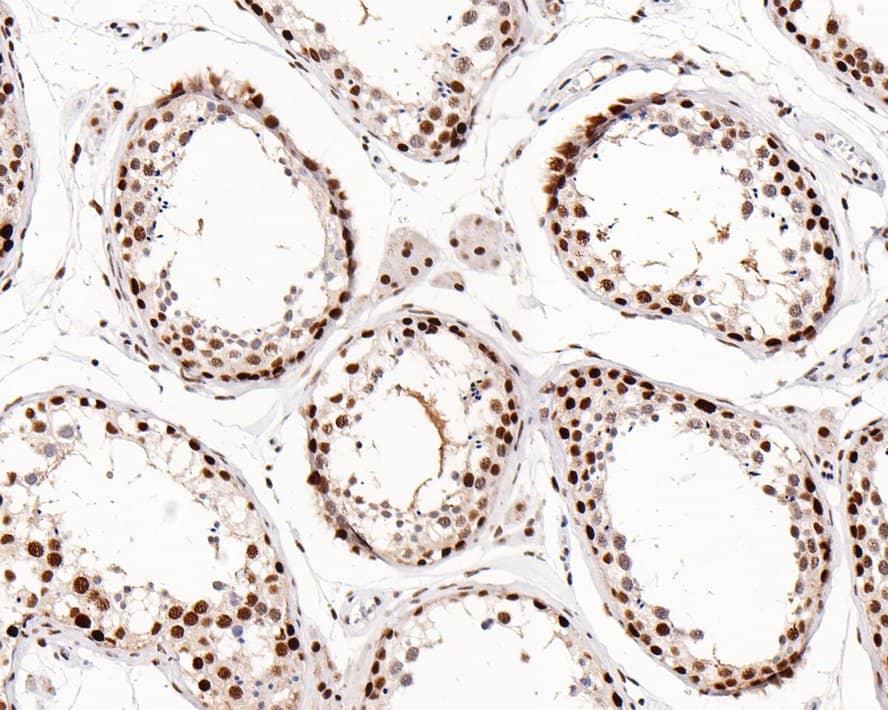 Immunohistochemistry: JMJD1B Antibody (1A8) [NBP3-32491] - Immunohistochemical analysis of paraffin-embedded human testis tissue with Rabbit anti-JMJD1B antibody (NBP3-32491) at 1/2,000 dilution. The section was pre-treated using heat mediated antigen retrieval with sodium citrate buffer (pH 6.0) for 2 minutes. The tissues were blocked in 1% BSA for 20 minutes at room temperature, washed with ddH2O and PBS, and then probed with the primary antibody (NBP3-32491) at 1/2,000 dilution for 1 hour at room temperature. The detection was performed using an HRP conjugated compact polymer system. DAB was used as the chromogen. Tissues were counterstained with hematoxylin and mounted with DPX.