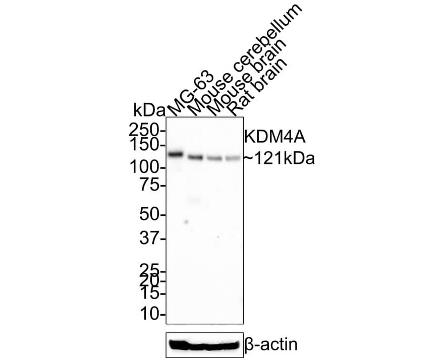 Western Blot: Lysine (K)-specific Demethylase 4A/KDM4A/JMJD2A Antibody (JE36-54) [NBP3-32492] - Western blot analysis of Lysine (K)-specific Demethylase 4A/KDM4A/JMJD2A on different lysates with Rabbit anti-Lysine (K)-specific Demethylase 4A/KDM4A/JMJD2A antibody (NBP3-32492) at 1/1,000 dilution. Lane 1: MG-63 cell lysate (20 ug/Lane) Lane 2: Mouse cerebellum tissue lysate (30 ug/Lane) Lane 3: Mouse brain tissue lysate (30 ug/Lane) Lane 4: Rat brain tissue lysate (30 ug/Lane) Predicted band size: 121 kDa Observed band size: 121 kDa Exposure time: 5 minutes; 4-20% SDS-PAGE gel. Proteins were transferred to a PVDF membrane and blocked with 5% NFDM/TBST for 1 hour at room temperature. The primary antibody (NBP3-32492) at 1/1,000 dilution was used in 5% NFDM/TBST at room temperature for 2 hours. Goat Anti-Rabbit IgG - HRP Secondary Antibody at 1:200,000 dilution was used for 1 hour at room temperature.