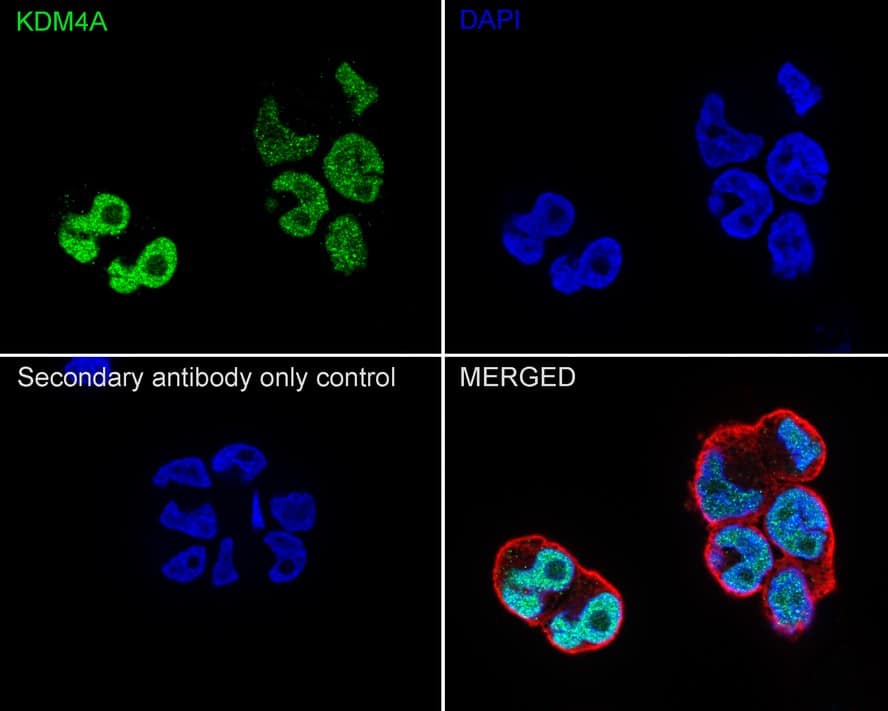 Immunocytochemistry/ Immunofluorescence: Lysine (K)-specific Demethylase 4A/KDM4A/JMJD2A Antibody (PSH03-67) [NBP3-32493] - Immunocytochemistry analysis of NCCIT cells labeling Lysine (K)-specific Demethylase 4A/KDM4A/JMJD2A with Rabbit anti-Lysine (K)-specific Demethylase 4A/KDM4A/JMJD2A antibody (NBP3-32493) at 1/100 dilution. Cells were fixed in 4% paraformaldehyde for 20 minutes at room temperature, permeabilized with 0.1% Triton X-100 in PBS for 5 minutes at room temperature, then blocked with 1% BSA in 10% negative goat serum for 1 hour at room temperature. Cells were then incubated with Rabbit anti-Lysine (K)-specific Demethylase 4A/KDM4A/JMJD2A antibody (NBP3-32493) at 1/100 dilution in 1% BSA in PBST overnight at 4 ℃. Goat Anti-Rabbit IgG H&L (iFluor™ 488) was used as the secondary antibody at 1/1,000 dilution. PBS instead of the primary antibody was used as the secondary antibody only control. Nuclear DNA was labelled in blue with DAPI. Beta tubulin (red) was stained at 1/100 dilution overnight at +4℃. Goat Anti-Mouse IgG H&L (iFluor™ 594) was used as the secondary antibody at 1/1,000 dilution.