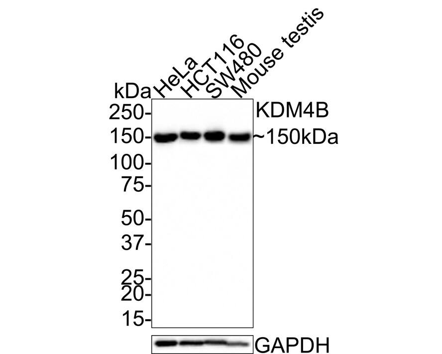 Western Blot JMJD2B Antibody (JE36-58)