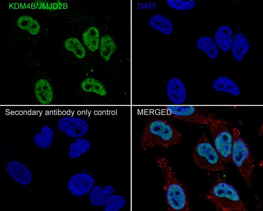 Immunocytochemistry/ Immunofluorescence: JMJD2B Antibody (JE36-58) [NBP3-32494] - Immunocytochemistry analysis of HeLa cells labeling JMJD2B with Rabbit anti-JMJD2B antibody (NBP3-32494) at 1/250 dilution. Cells were fixed in 4% paraformaldehyde for 10 minutes at 37 ℃, permeabilized with 0.05% Triton X-100 in PBS for 20 minutes, and then blocked with 2% negative goat serum for 30 minutes at room temperature. Cells were then incubated with Rabbit anti-JMJD2B antibody (NBP3-32494) at 1/250 dilution in 2% negative goat serum overnight at 4 ℃. Goat Anti-Rabbit IgG H&L (iFluor™ 488) was used as the secondary antibody at 1/1,000 dilution. Nuclear DNA was labelled in blue with DAPI. Beta tubulin (red) was stained at 1/100 dilution overnight at +4℃. Goat Anti-Mouse IgG H&L (iFluor™ 594) was used as the secondary antibody at 1/1,000 dilution.