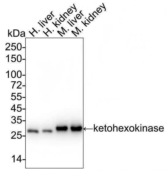 Western blot analysis on different lysates with NBP3-32496 at 1/2,000 dilution and competitor's antibody at 1/1,000 dilution. Lane 1: Human liver tissue lysate Lane 2: Human kidney tissue lysate Lane 3: Mouse liver tissue lysate Lane 4: Mouse kidney tissue lysate Lysates/proteins at 20 µg/Lane. Predicted band size: 33 kDa Observed band size: 33 kDa Exposure time: 5 seconds;  4-20% SDS-PAGE gel. Proteins were transferred to a PVDF membrane and blocked with 5% NFDM/TBST for 1 hour at room temperature. NBP3-32496 at 1/2,000 dilution and competitor's antibody at 1/1,000 dilution were used in 5% NFDM/TBST at 4℃ overnight. Goat Anti-Rabbit IgG [HRP] Secondary Antibody at 1/50,000 dilution was used for 1 hour at room temperature.