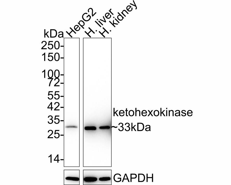 Western blot analysis on different lysates with NBP3-32497 at 1/2,000 dilution. Lane 1: HepG2 cell lysate Lane 2: Human liver tissue lysate Lane 3: Human kidney tissue lysate Lysates/proteins at 20 µg/Lane. Predicted band size: 33 kDa Observed band size: 33 kDa Exposure time: 11 seconds; 4-20% SDS-PAGE gel. Proteins were transferred to a PVDF membrane and blocked with 5% NFDM/TBST for 1 hour at room temperature. NBP3-32497 at 1/2,000 dilution was used in 5% NFDM/TBST at 4℃ overnight. Goat Anti-Rabbit IgG [HRP] Secondary Antibody at 1/50,000 dilution was used for 1 hour at room temperature.