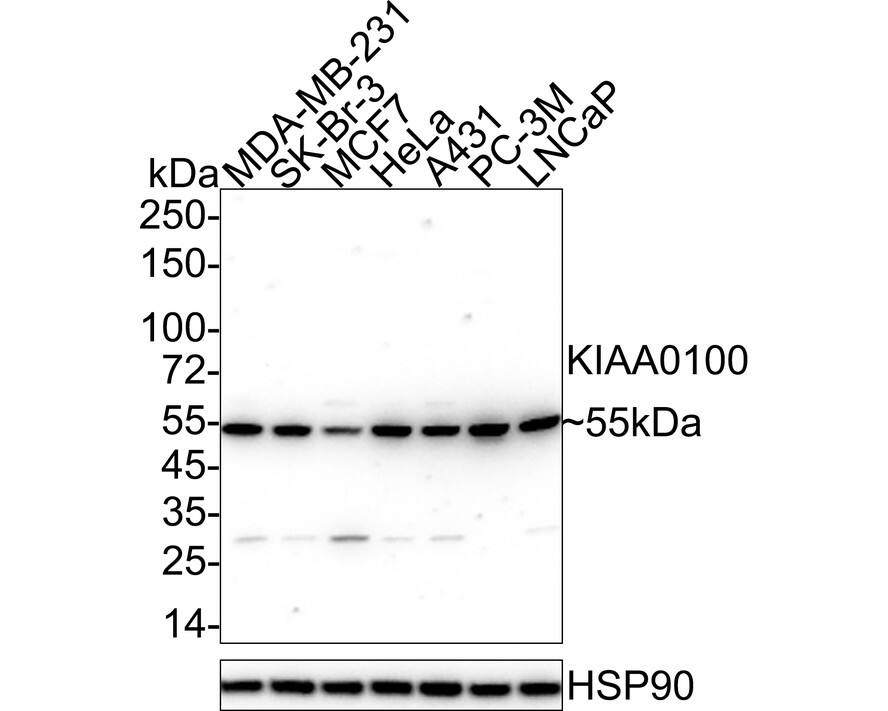 Western blot analysis of BLTP2 on different lysates with BLTP2 Antibody (A0-F3-R) at 1/1,000 dilution. Lane 1: MDA-MB-231 cell lysate Lane 2: SK-Br-3 cell lysate Lane 3: MCF7 cell lysate Lane 4: HeLa cell lysate Lane 5: A431 cell lysate Lane 6: PC-3M cell lysate Lane 7: LNCaP cell lysate Lysates/proteins at 20 ug/Lane. Predicted band size: 254 kDa Observed band size: 55 kDa Exposure time: 1 minute 2 seconds; ECL; 4-20% SDS-PAGE gel. Proteins were transferred to a PVDF membrane and blocked with 5% NFDM/TBST for 1 hour at room temperature. The primary antibody (NBP3-32500) at 1/1,000 dilution was used in 5% NFDM/TBST at 4  overnight. Goat Anti-Mouse IgG - HRP Secondary Antibody at 1/50,000 dilution was used for 1 hour at room temperature.