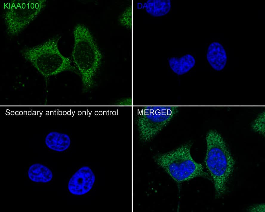 Immunocytochemistry analysis of HeLa cells labeling K0100 with BLTP2 Antibody (A0-F3-R) at 1/100 dilution. Cells were fixed in 100% precooled methanol for 5 minutes at room temperature, then blocked with 1% BSA in 10% negative goat serum for 1 hour at room temperature. Cells were then incubated with BLTP2 Antibody (A0-F3-R) at 1/100 dilution in 1% BSA in PBST overnight at 4 ℃. Goat Anti-Mouse IgG H&L (iFluor™ 488) was used as the secondary antibody at 1/1,000 dilution. PBS instead of the primary antibody was used as the secondary antibody only control. Nuclear DNA was labelled in blue with DAPI.