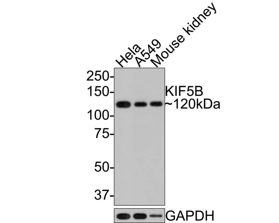 Western Blot: Kinesin 5B Antibody (JE64-16) [NBP3-32503] - Western blot analysis of Kinesin 5B on different lysates with Rabbit anti-Kinesin 5B antibody at 1/500 dilution. Lane 1: HeLa cell lysate, 10 ug/Lane Lane 2: A549 cell lysate, 10 ug/Lane Lane 3: Mouse kidney tissue lysate, 20 ug/Lane Predicted band size: 110 kDa Observed band size: 110 kDa Exposure time: 1 minute; 8 % SDS-PAGE gel. Proteins were transferred to a PVDF membrane and blocked with 5% NFDM/TBST for 1 hour at room temperature. The primary antibody KIF5B at 1/500 dilution was used in 5% NFDM/TBST at room temperature for 2 hours. Goat Anti-Rabbit IgG - HRP Secondary Antibody at 1:300,000 dilution was used for 1 hour at room temperature.