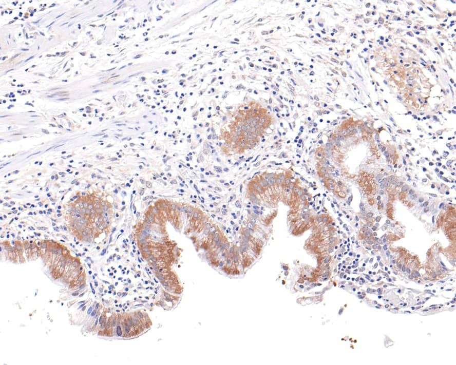 Immunohistochemistry: Kinesin 5B Antibody (JE64-16) [NBP3-32503] - Immunohistochemical analysis of paraffin-embedded human gallbladder tissue with Rabbit anti-Kinesin 5B antibody (NBP3-32503) at 1/100 dilution. The section was pre-treated using heat mediated antigen retrieval with Tris-EDTA buffer (pH 9.0) for 20 minutes. The tissues were blocked in 1% BSA for 20 minutes at room temperature, washed with ddH2O and PBS, and then probed with the primary antibody KIF5B at 1/100 dilution for 1 hour at room temperature. The detection was performed using an HRP conjugated compact polymer system. DAB was used as the chromogen. Tissues were counterstained with hematoxylin and mounted with DPX.