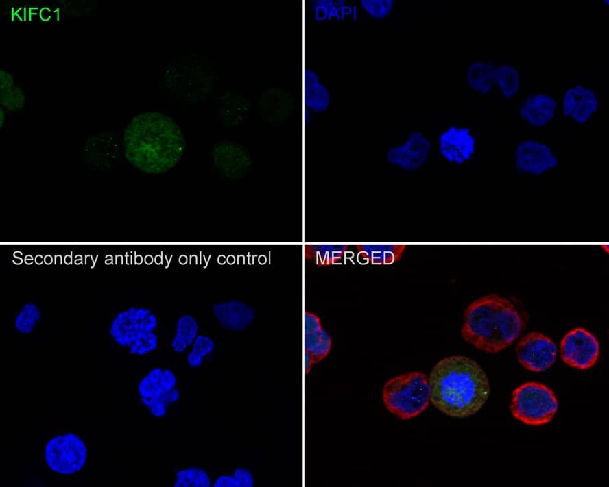 Immunocytochemistry/ Immunofluorescence: KIFC1 Antibody (JE00-46) [NBP3-32504] - Immunocytochemistry analysis of Jurkat cells labeling KIFC1 with Rabbit anti-KIFC1 antibody (NBP3-32504) at 1/100 dilution. Cells were fixed in 4% paraformaldehyde for 20 minutes at room temperature, permeabilized with 0.1% Triton X-100 in PBS for 5 minutes at room temperature, then blocked with 1% BSA in 10% negative goat serum for 1 hour at room temperature. Cells were then incubated with Rabbit anti-KIFC1 antibody (NBP3-32504) at 1/100 dilution in 1% BSA in PBST overnight at 4 ℃. Goat Anti-Rabbit IgG H&L (iFluor™ 488) was used as the secondary antibody at 1/1,000 dilution. PBS instead of the primary antibody was used as the secondary antibody only control. Nuclear DNA was labelled in blue with DAPI. Beta tubulin (red) was stained at 1/100 dilution overnight at +4℃. Goat Anti-Mouse IgG H&L (iFluor™ 594) was used as the secondary antibody at 1/1,000 dilution.