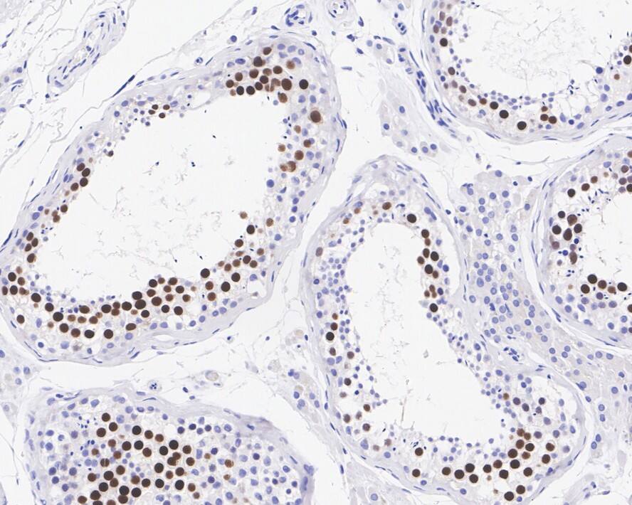 Immunohistochemistry: KIFC1 Antibody (JE00-46) [NBP3-32504] - Immunohistochemical analysis of paraffin-embedded human testis tissue with Rabbit anti-KIFC1 antibody (NBP3-32504) at 1/1,000 dilution. The section was pre-treated using heat mediated antigen retrieval with sodium citrate buffer (pH 6.0) for 2 minutes. The tissues were blocked in 1% BSA for 20 minutes at room temperature, washed with ddH2O and PBS, and then probed with the primary antibody (NBP3-32504) at 1/1,000 dilution for 1 hour at room temperature. The detection was performed using an HRP conjugated compact polymer system. DAB was used as the chromogen. Tissues were counterstained with hematoxylin and mounted with DPX.