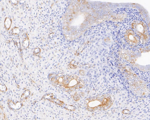 Immunohistochemistry: Kir2.1 Antibody (JE54-56) [NBP3-32505] - Immunohistochemical analysis of paraffin-embedded rat uterus tissue using anti-Kir2.1 antibody. The section was pre-treated using heat mediated antigen retrieval with sodium citrate buffer (pH 6.0) for 20 minutes. The tissues were blocked in 5% BSA for 30 minutes at room temperature, washed with ddH2O and PBS, and then probed with the primary antibody (NBP3-32505, 1/400) for 30 minutes at room temperature. The detection was performed using an HRP conjugated compact polymer system. DAB was used as the chromogen. Tissues were counterstained with hematoxylin and mounted with DPX.