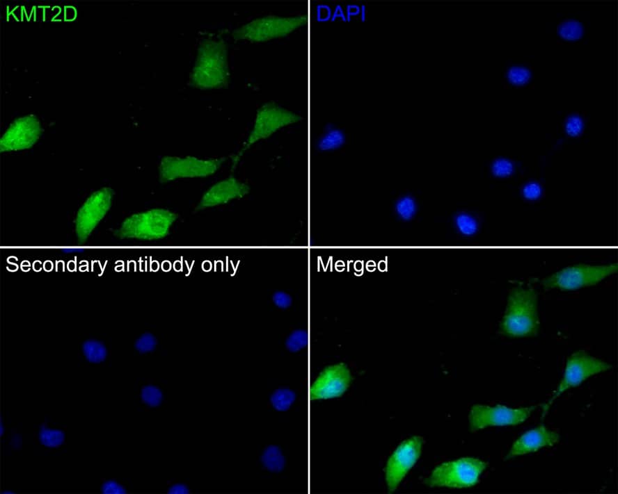 Immunocytochemistry/ Immunofluorescence: KMT2D Antibody [NBP3-32508] - Immunocytochemistry analysis of A549 cells labeling KMT2D with Rabbit anti-KMT2D antibody (NBP3-32508) at 1/100 dilution. Cells were fixed in 4% paraformaldehyde for 10 minutes at 37 ℃, permeabilized with 0.05% Triton X-100 in PBS for 20 minutes, and then blocked with 2% negative goat serum for 30 minutes at room temperature. Cells were then incubated with Rabbit anti-KMT2D antibody (NBP3-32508) at 1/100 dilution in 2% negative goat serum overnight at 4 ℃. Goat Anti-Rabbit IgG H&L (iFluor™ 488) was used as the secondary antibody at 1/1,000 dilution. PBS instead of the primary antibody was used as the secondary antibody only control. Nuclear DNA was labelled in blue with DAPI.