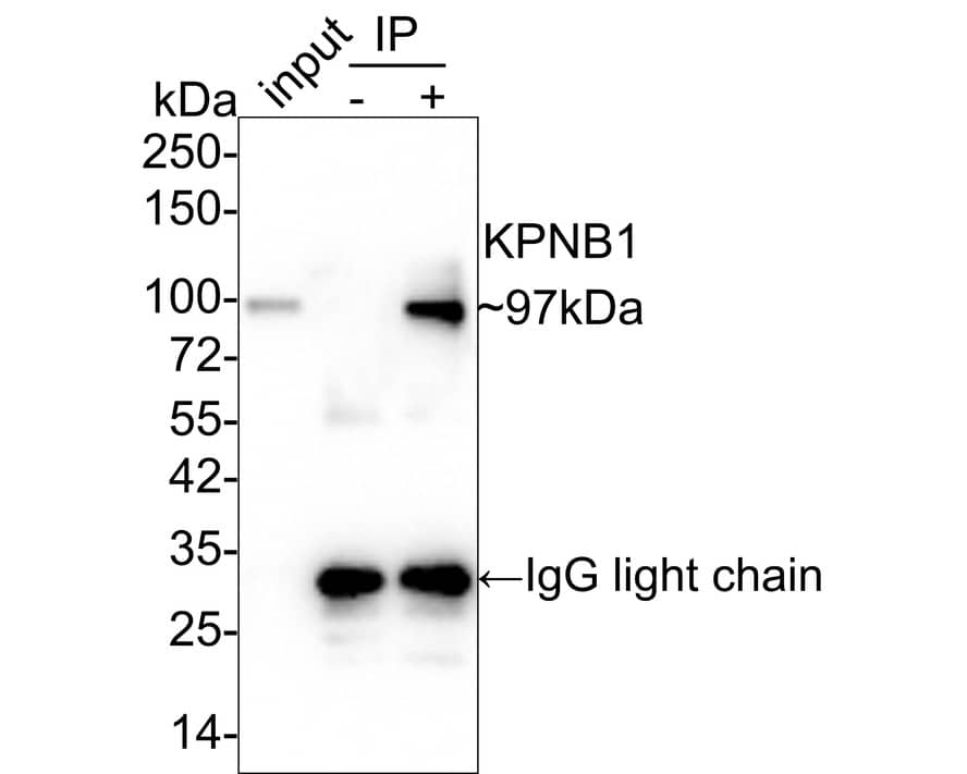 Immunoprecipitation: Importin beta/KPNB1 Antibody (PSH01-59) [NBP3-32510] - Importin beta/KPNB1 was immunoprecipitated in 0.2mg HeLa cell lysate with NBP3-32510 at 2 ug/25 ul agarose. Western blot was performed from the immunoprecipitate using NBP3-32510 at 1/1,000 dilution. Anti-Rabbit IgG for IP Nano-secondary antibody at 1/5,000 dilution was used for 1 hour at room temperature. Lane 1: HeLa cell lysate (input) Lane 2: Rabbit IgG instead of NBP3-32510 in HeLa cell lysate Lane 3: NBP3-32510 IP in HeLa cell lysate Blocking/Dilution buffer: 5% NFDM/TBST Exposure time: 24 seconds