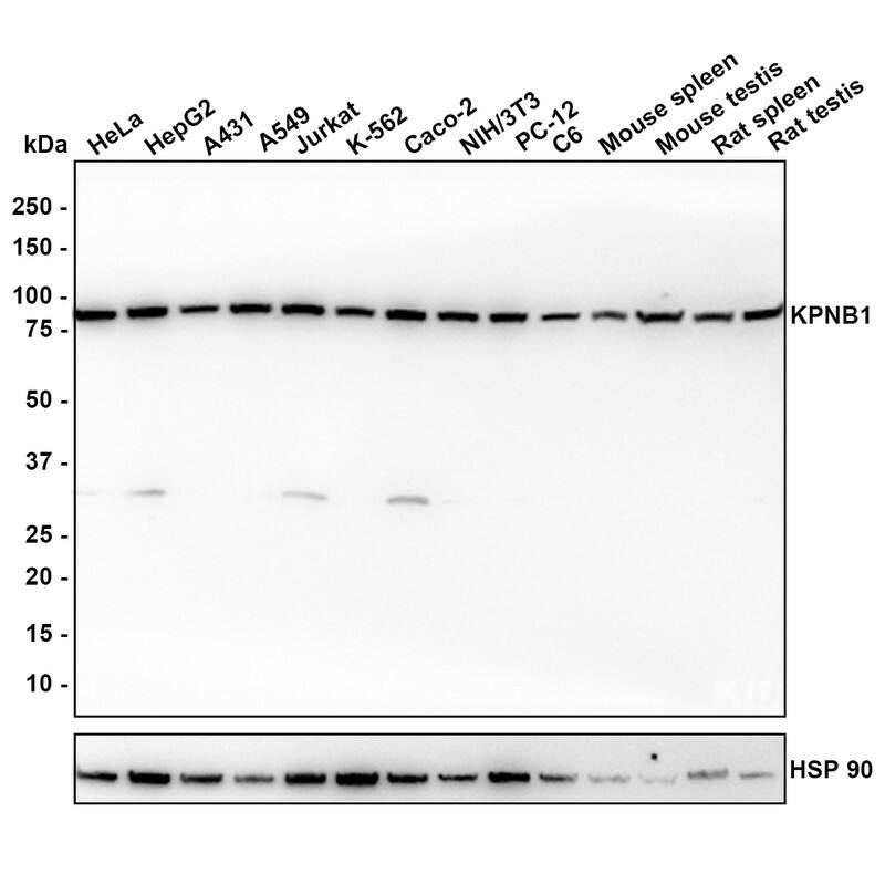 Western blot analysis on different lysates with NBP3-32511 at 1/1,000 dilution. Lane 1: HeLa cell lysate (20 µg/Lane) Lane 2: HepG2 cell lysate (20 µg/Lane) Lane 3: A431 cell lysate (20 µg/Lane) Lane 4: A549 cell lysate (20 µg/Lane) Lane 5: Jurkat cell lysate (20 µg/Lane) Lane 6: K-562 cell lysate (20 µg/Lane) Lane 7: Caco-2 cell lysate (20 µg/Lane) Lane 8: NIH/3T3 cell lysate (20 µg/Lane) Lane 9: PC-12 cell lysate (20 µg/Lane) Lane 10: C6 cell lysate (20 µg/Lane) Lane 11: Mouse spleen tissue lysate (40 µg/Lane) Lane 12: Mouse testis tissue lysate (40 µg/Lane) Lane 13: Rat spleen tissue lysate (40 µg/Lane) Lane 14: Rat testis tissue lysate (40 µg/Lane) Predicted band size: 97 kDa Observed band size: 97 kDa Exposure time: 1 minute; 4-20% SDS-PAGE gel. Proteins were transferred to a PVDF membrane and blocked with 5% NFDM/TBST for 1 hour at room temperature. NBP3-32511 at 1/1,000 dilution was used in 5% NFDM/TBST at room temperature for 2 hours. Goat Anti-Rabbit IgG [HRP] Secondary Antibody at 1/100,000 dilution was used for 1 hour at room temperature.