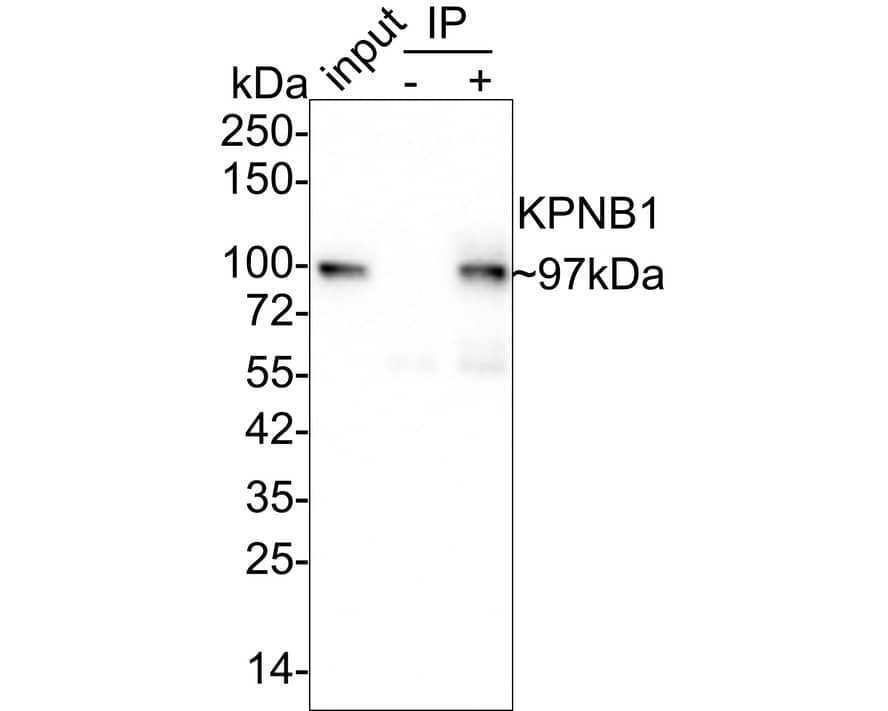 Immunoprecipitation: Importin beta/KPNB1 Antibody (PSH01-60) [NBP3-32511] - Importin beta/KPNB1 was immunoprecipitated in 0.2mg HeLa cell lysate with NBP3-32511 at 2 ug/25 ul agarose. Western blot was performed from the immunoprecipitate using NBP3-32511 at 1/1,000 dilution. Anti-Rabbit IgG for IP Nano-secondary antibody at 1/5,000 dilution was used for 1 hour at room temperature. Lane 1: HeLa cell lysate (input) Lane 2: Rabbit IgG instead of NBP3-32511 in HeLa cell lysate Lane 3: NBP3-32511 IP in HeLa cell lysate Blocking/Dilution buffer: 5% NFDM/TBST Exposure time: 24 seconds