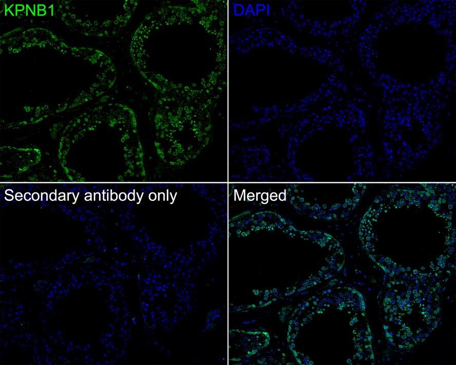 Immunohistochemistry: Importin beta/KPNB1 Antibody (PSH01-60) [NBP3-32511] - Immunofluorescence analysis of paraffin-embedded human testis tissue labeling Importin beta/KPNB1 with Rabbit anti-Importin beta/KPNB1 antibody (NBP3-32511) at 1/200 dilution. The section was pre-treated using heat mediated antigen retrieval with Tris-EDTA buffer (pH 9.0) for 20 minutes. The tissues were blocked in 10% negative goat serum for 1 hour at room temperature, washed with PBS, and then probed with the primary antibody (NBP3-32511, green) at 1/200 dilution overnight at 4 ℃, washed with PBS. Goat Anti-Rabbit IgG H&L (iFluor™ 488) was used as the secondary antibody at 1/1,000 dilution. Nuclei were counterstained with DAPI (blue).